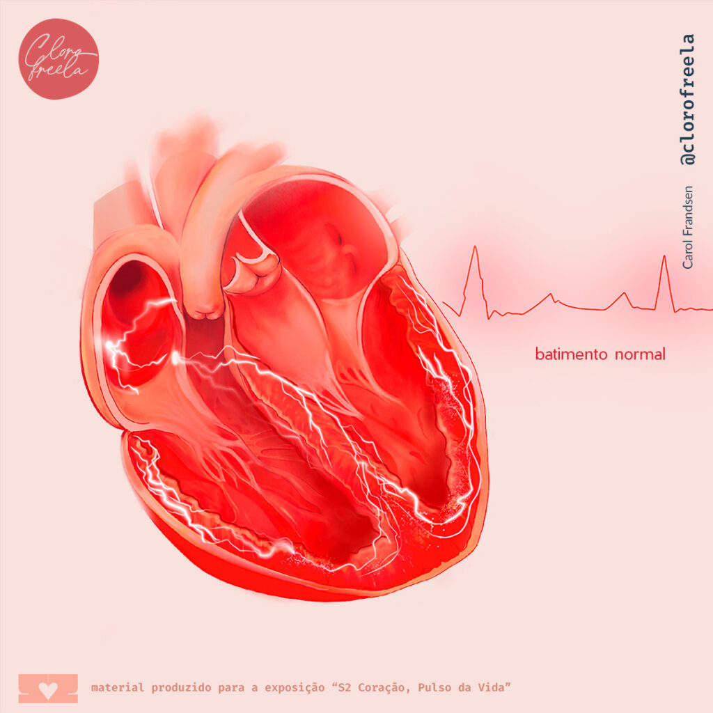 Fibrila O Atrial Clorofreela Biomedical Illustration